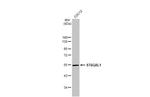 ST6GAL1 Antibody in Western Blot (WB)