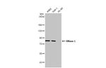 RNaseL Antibody in Western Blot (WB)