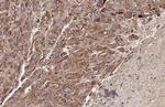 PELO Antibody in Immunohistochemistry (Paraffin) (IHC (P))