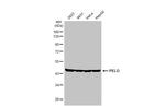 PELO Antibody in Western Blot (WB)