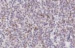 TNF alpha Antibody in Immunohistochemistry (Paraffin) (IHC (P))