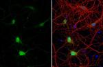 Calbindin D28K Antibody in Immunocytochemistry (ICC/IF)