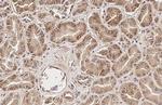 SUCLG1 Antibody in Immunohistochemistry (Paraffin) (IHC (P))