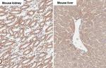 SUCLG1 Antibody in Immunohistochemistry (Paraffin) (IHC (P))