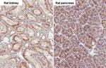 SUCLG1 Antibody in Immunohistochemistry (Paraffin) (IHC (P))