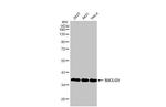 SUCLG1 Antibody in Western Blot (WB)