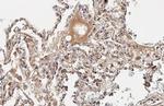 IL-6 Antibody in Immunohistochemistry (Paraffin) (IHC (P))