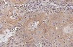 IL-6 Antibody in Immunohistochemistry (Paraffin) (IHC (P))