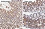 TBC1D5 Antibody in Immunohistochemistry (Paraffin) (IHC (P))