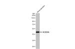 BCKDHA Antibody in Western Blot (WB)