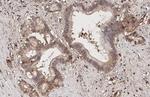 CXCR4 Antibody in Immunohistochemistry (Paraffin) (IHC (P))