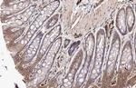 CXCR4 Antibody in Immunohistochemistry (Paraffin) (IHC (P))