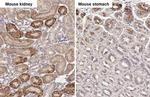 Calpain 5 Antibody in Immunohistochemistry (Paraffin) (IHC (P))