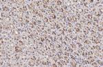 Calpain 5 Antibody in Immunohistochemistry (Paraffin) (IHC (P))