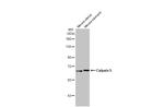 Calpain 5 Antibody in Western Blot (WB)