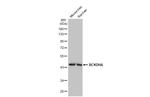 BCKDHA Antibody in Western Blot (WB)