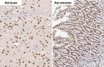 FUS Antibody in Immunohistochemistry (Paraffin) (IHC (P))