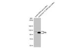 Rb Antibody in Western Blot (WB)