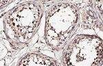 NEK2 Antibody in Immunohistochemistry (Paraffin) (IHC (P))