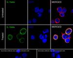 IL-1 beta Antibody in Immunocytochemistry (ICC/IF)