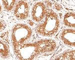 STRAP Antibody in Immunohistochemistry (Paraffin) (IHC (P))