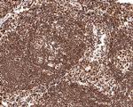 BRCA1 Antibody in Immunohistochemistry (Paraffin) (IHC (P))