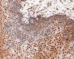 BRCA1 Antibody in Immunohistochemistry (Paraffin) (IHC (P))