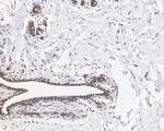 BRCA1 Antibody in Immunohistochemistry (Paraffin) (IHC (P))