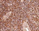 CD73 Antibody in Immunohistochemistry (Paraffin) (IHC (P))