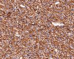 CD73 Antibody in Immunohistochemistry (Paraffin) (IHC (P))