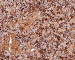 CD73 Antibody in Immunohistochemistry (Paraffin) (IHC (P))