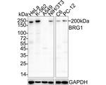 BRG1 Antibody in Western Blot (WB)