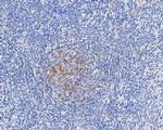 CD35 Antibody in Immunohistochemistry (Paraffin) (IHC (P))