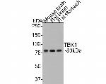 TBK1 Antibody in Western Blot (WB)