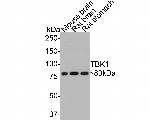 TBK1 Antibody in Western Blot (WB)