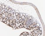 K-Ras Antibody in Immunohistochemistry (Paraffin) (IHC (P))