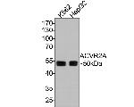 ACVR2A Antibody in Western Blot (WB)