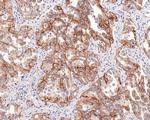 c-Met Antibody in Immunohistochemistry (Paraffin) (IHC (P))