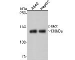 c-Met Antibody in Western Blot (WB)