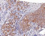 c-Met Antibody in Immunohistochemistry (Paraffin) (IHC (P))