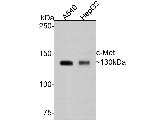 c-Met Antibody in Western Blot (WB)