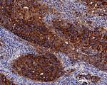 NAPSA Antibody in Immunohistochemistry (Paraffin) (IHC (P))