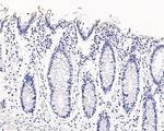 NAPSA Antibody in Immunohistochemistry (Paraffin) (IHC (P))