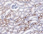 ACSL1 Antibody in Immunohistochemistry (Paraffin) (IHC (P))