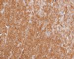 ACSL1 Antibody in Immunohistochemistry (Paraffin) (IHC (P))