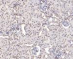 WDR41 Antibody in Immunohistochemistry (Paraffin) (IHC (P))