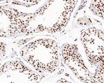 WDR41 Antibody in Immunohistochemistry (Paraffin) (IHC (P))