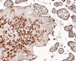 ROBO1 Antibody in Immunohistochemistry (Paraffin) (IHC (P))