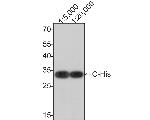 6x His Tag Antibody in Western Blot (WB)