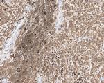 S100B Antibody in Immunohistochemistry (Paraffin) (IHC (P))